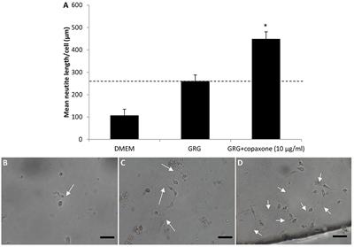 Reviving Matrix for Nerve Reconstruction in Rabbit Model of Chronic Peripheral Nerve Injury With Massive Loss Defect